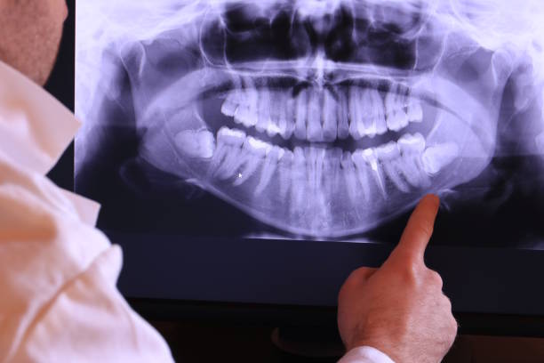 Tooth Infection Emergency Dentist in CT